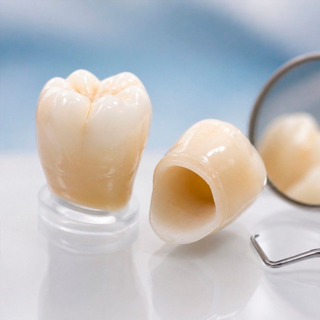 Prótesis fija dental - Coronas de porcelana y zirconia