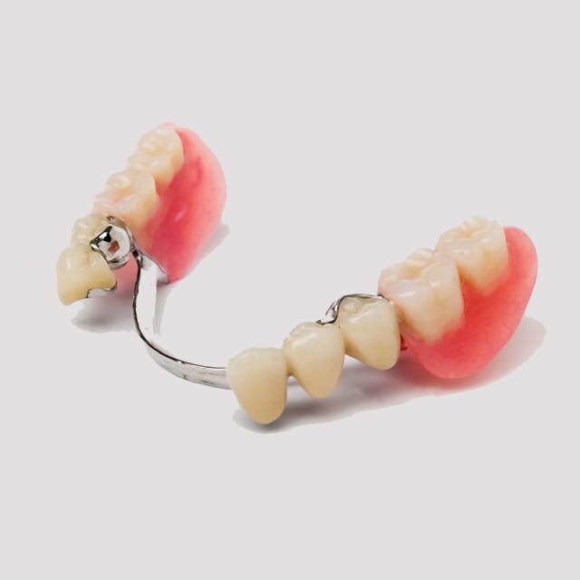 Prótesis parcial removible con retenedores y dientes artificiales